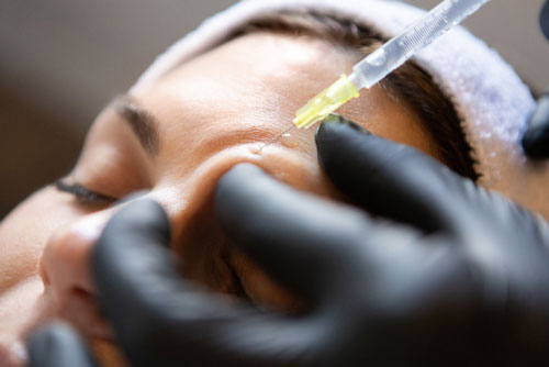 Anti Wrinkle Injections and dermal fillers